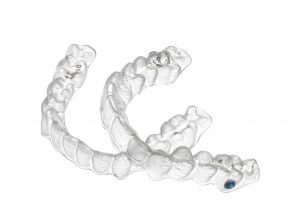 Invisalign Cardiff