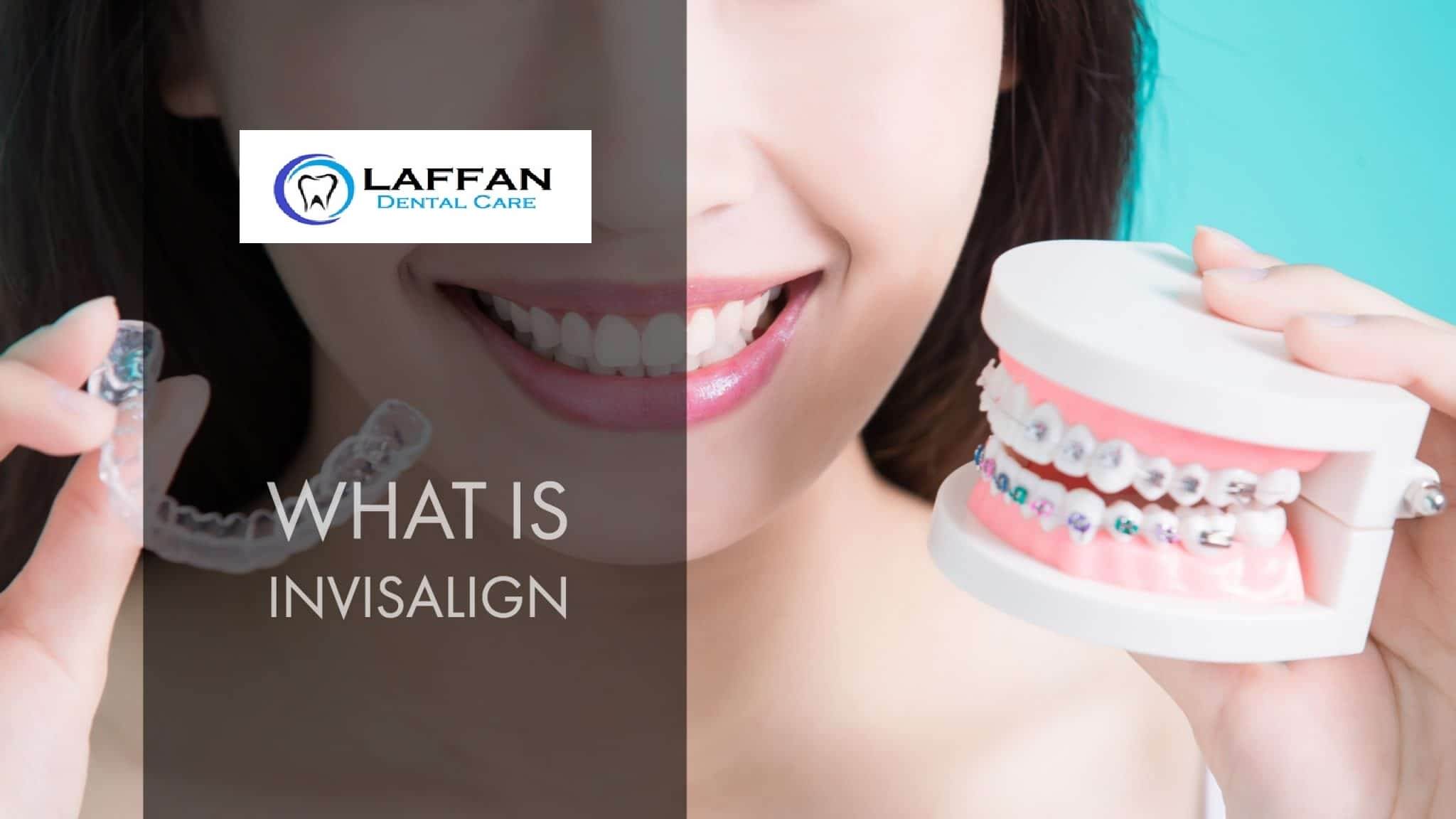 What is Invisalign? | Laffan Dental Care