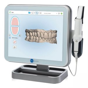 itero 3d braces