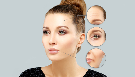 Treatment of Lines & Wrinkles